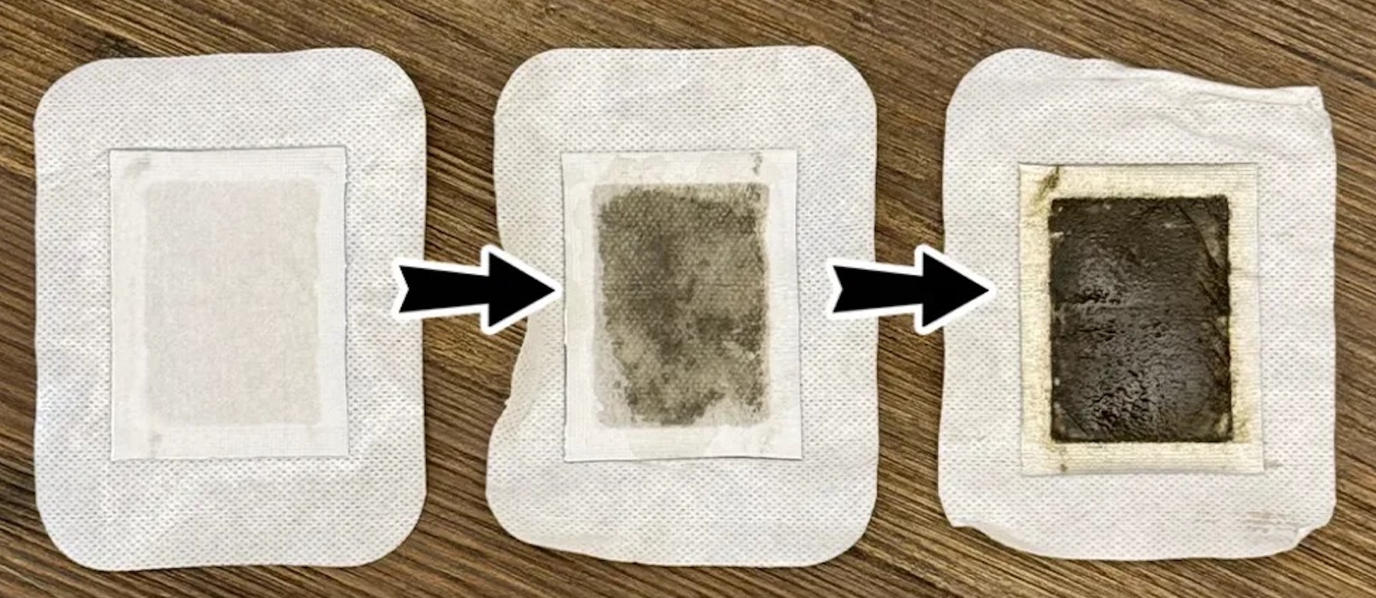 Possible color changes in used DetoxNatura patches