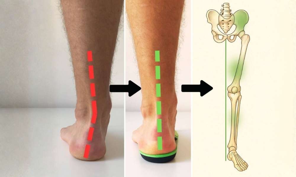 Orthexa durability