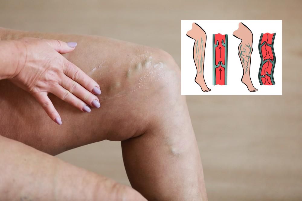 Lower legs with visible veins