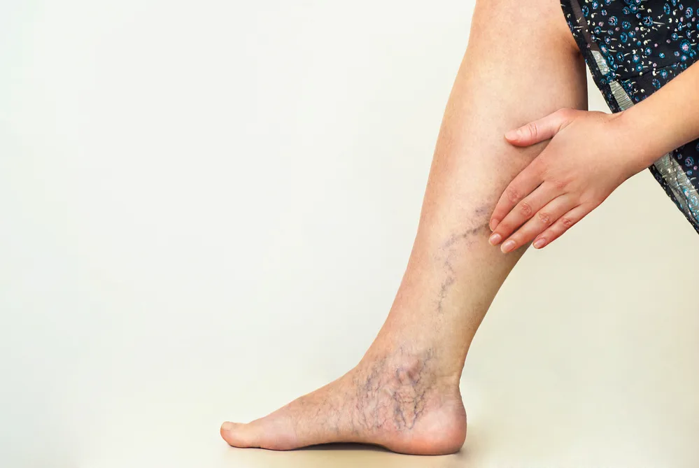 Leg comfort on the Medical leg-elevation pillow