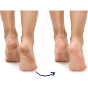 ZIAJA Foot Cream for Cracked Skin 60ml - Image 2