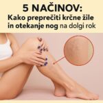 5 everyday tips for leg care