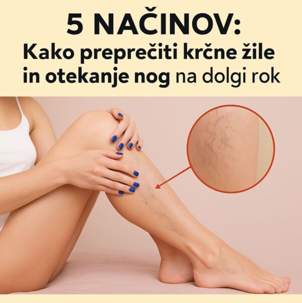 5 everyday tips for leg care